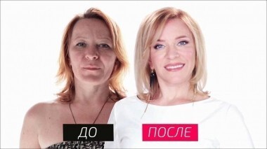 На 10 лет моложе. Выпуск от 03.09.2016