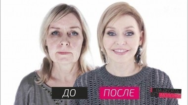 На 10 лет моложе. Выпуск от 11.03.2017