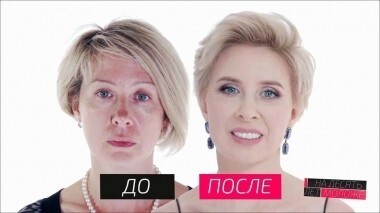 На 10 лет моложе. Выпуск от 21.01.2017