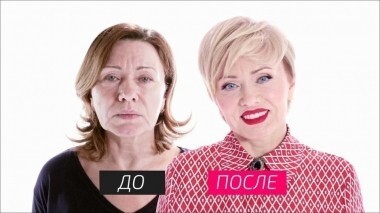 На 10 лет моложе. Выпуск от 25.06.2016