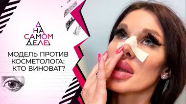 Обезображенная модель разоблачает элитного косметолога. На самом деле. Выпуск от 16.05.2021