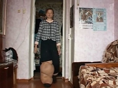 Хождение по мукам. Пусть говорят. Выпуск от 21.09.2011