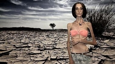 Кожа да кости. Пусть говорят. Выпуск от 22.10.2014