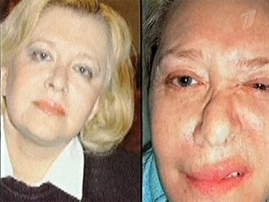 Красавица и чудовище. Пусть говорят. Выпуск от 08.12.2010