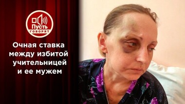 Муж избитой учительницы впервые раскрывает свою правду. Пусть говорят. Выпуск от 20.01.2021