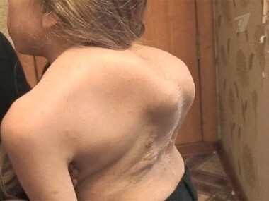 На чужом горбу. Пусть говорят. Выпуск от 09.03.2011