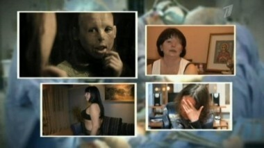 Подайте на пластику. Пусть говорят. Выпуск от 18.03.2013