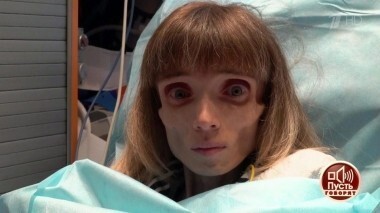 Вес — 17 килограммов: «леди совершенство» на грани жизни и смерти. Пусть говорят. Выпуск от 08.10.2018