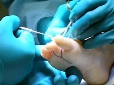 Здоровье. Выпуск от 07.11.2010