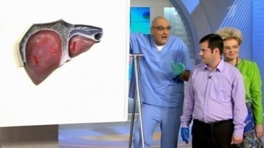 Жить здорово! Выпуск от 05.07.2013